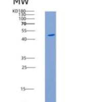 人ICOS Ligand / B7-H2 / ICOSLG重组蛋白Fc tag