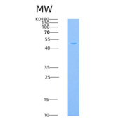 小鼠CAMK4 / CaMKIV重组蛋白