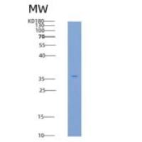 人STK10 / LOK重组蛋白His ta
