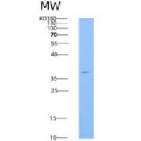 小鼠IL18R1 / CD218a重组蛋白His tag