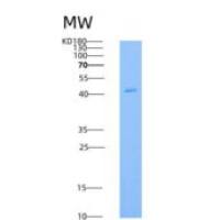 人TRAIL R1 / CD261 / TNFRSF10A重组蛋白Fc tag