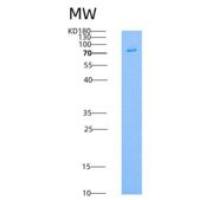 人MST4重组蛋白GST tag