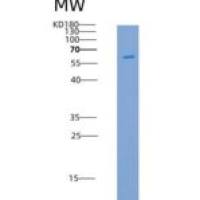 人PAK3重组蛋白His tag
