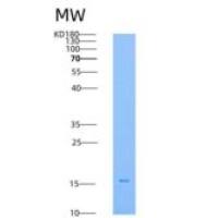 人TRAIL R1 / CD261 / TNFRSF10A重组蛋白His tag