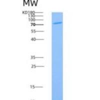 小鼠解整合素金属蛋白酶9(ADAM9)重组蛋白His tag