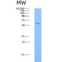 人IDO1 / IDO重组蛋白His tag