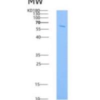 人IL18RAP / IL1R7重组蛋白Fc tag