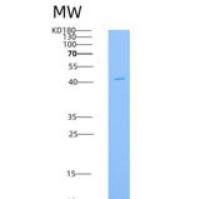 人BMPRIA / ALK-3 / CD292重组蛋白His & Fc tag