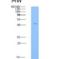 人TRAIL R4 / CD264 / TNFRSF10D重组蛋白His & Fc tag