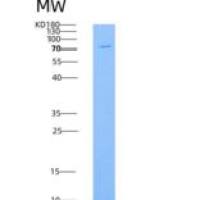 大鼠PDGFRa / CD140a重组蛋白Fc tag