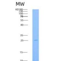 人IL4R / CD124重组蛋白His tag