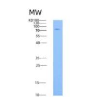 小鼠Transferrin Receptor / TFRC / CD71重组蛋白His tag
