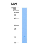 人TRAIL R2 / CD262 / TNFRSF10B重