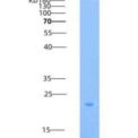 人CD2分子(CD2)重组蛋白His Tag