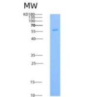 大鼠PDGFRa / CD140a重组蛋白His tag