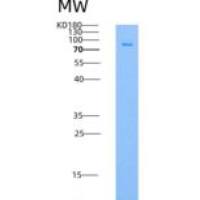 人GALK1 / Galactokinase / Galactose kinase重组