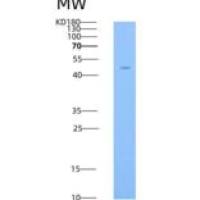 小鼠GFRA2 / GFRα2 / GDNFRB重组蛋白His tag