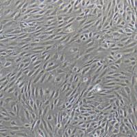 人肺动脉内皮细胞(原代)