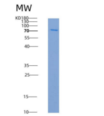 人MVK /甲羟戊酸激酶重组蛋白His & GST tag