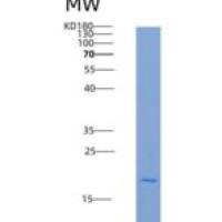 小鼠TIMP1 / TIMP / CLGI重组蛋白