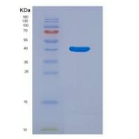 人非受体型蛋白酪氨酸磷酸酶1(PTPN1)重组蛋白