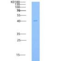 人CD30 / TNFRSF8重组蛋白His tag
