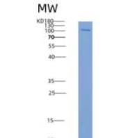 人PRKD2 / PKD2重组蛋白His & GST tag