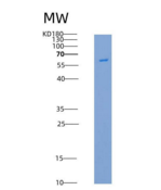 人PAK3重组蛋白His tag