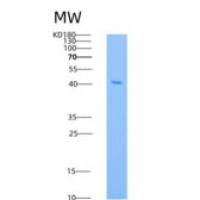 人RRM2B / P53R2重组蛋白His tag