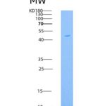 人GFRA1 / GFRα1 / GDNFRA重组蛋白His tag
