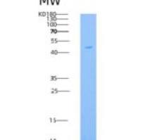 人GFRA1 / GFRα1 / GDNFRA重组蛋白His tag