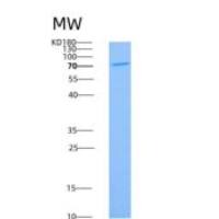 大鼠CD36 / SCARB3重组蛋白Fc tag