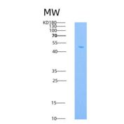 小鼠TNFR2 / CD120b / TNFRSF1B重组蛋白Fc tag