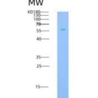 人KIM-1 / TIM1 / HAVCR1重组蛋白His & Fc tag