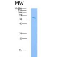 人TRIB2 / TRB2重组蛋白His & GST tag