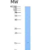 小鼠骨成型蛋白受体1A(BMPR1A)重组蛋白His Tag