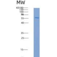 人CDKL2重组蛋白His tag