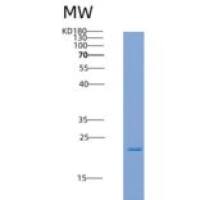 人LFA-3 / CD58重组蛋白His tag