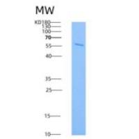 小鼠CSF1R / MCSF Receptor / CD115重组蛋白His tag