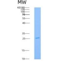 人AK4 / Adenylate Kinase 4 / AK3L1重组蛋白