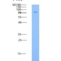 人CHK1 / CHEK1重组蛋白GST tag