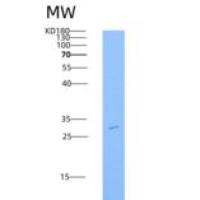 人TGFB1 (LAP) / TGF-beta 1重组蛋白His Tag