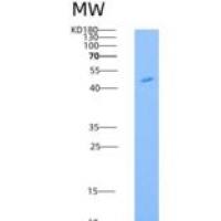 小鼠Legumain重组蛋白His Tag