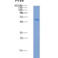 小鼠TRAIL R2 / CD262 / TNFRSF10B重组蛋白His & Fc tag