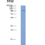 人MVK /甲羟戊酸激酶重组蛋白His & GST tag