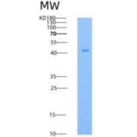 小鼠FGFR1 / CD331重组蛋白His tag