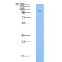 人C-Src酪氨酸激酶(CSK)重组蛋白GST tag
