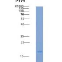 人Frizzled-5 / FZD5重组蛋白His tag