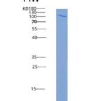 人FES Kinase / Feline sarcoma oncogene重组蛋白His & GST tag