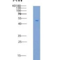 小鼠CD80 / B7-1重组蛋白Fc tag